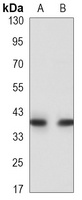 HLA-A Antibody
