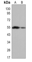 ALDH1A1 Antibody