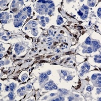 ALDH1A1 Antibody