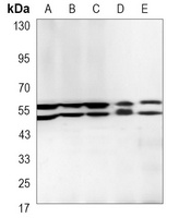 LYN Mouse Monoclonal Antibody