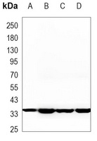 Aldose Reductase Mouse Monoclonal Antibody