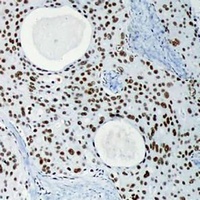 Anti-DNA-PKcs Antibody