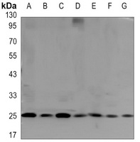 GRB2 Mouse Monoclonal Antibody