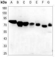 B-RAF Mouse Monoclonal Antibody