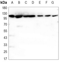 Hexokinase 1 Mouse Monoclonal Antibody