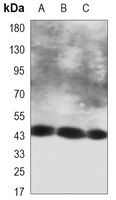 Cytokeratin 18 Mouse Monoclonal Antibody