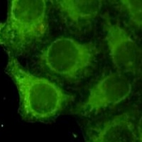Cytokeratin 18 Mouse Monoclonal Antibody