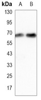 ALB Antibody