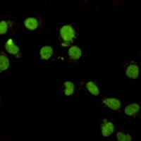 Anti-CHD3 Antibody