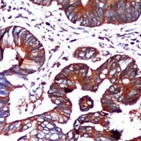 Anti-GRP78 Antibody