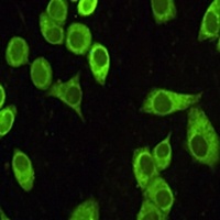 Anti-GRP78 Antibody