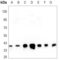 GAPDH Mouse Monoclonal Antibody