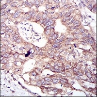 Anti-GSK3 beta Antibody