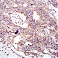 GSK3 beta antibody