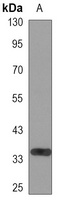 Kallikrein 3 Mouse Monoclonal Antibody