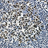 Anti-MCM2 Antibody