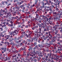 Anti-Metadherin Antibody