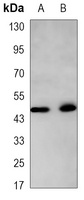 Cytokeratin 18 Mouse Monoclonal Antibody