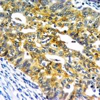 Cytokeratin 18 Mouse Monoclonal Antibody