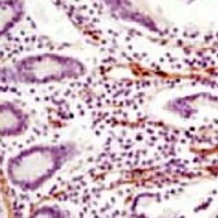 Anti-LPP Antibody