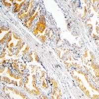 Anti-GSTP1 Antibody