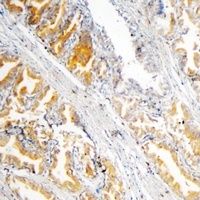 GSTP1 antibody