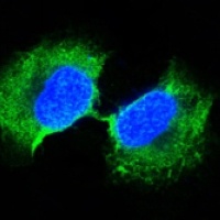 Anti-GSTP1 Antibody