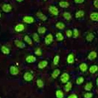 Anti-MLH1 Antibody