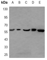 HARS Mouse Monoclonal Antibody