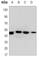 Lupus La Antibody
