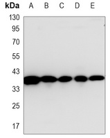 MKK6 Mouse Monoclonal Antibody