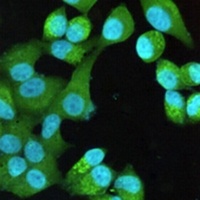 Anti-S100-A10 Antibody