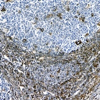 Vimentin Antibody