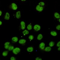Anti-RBBP5 Antibody