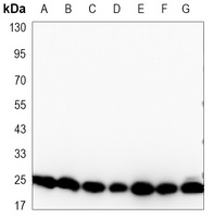 EIF4E Mouse Monoclonal Antibody