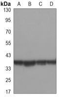 ERCC1 Mouse Monoclonal Antibody