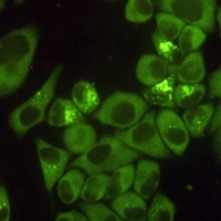 Anti-DDX3X Antibody