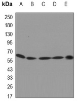 Cytokeratin 5 Antibody