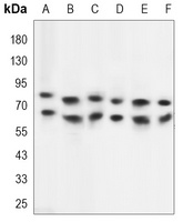 TAK1 Mouse Monoclonal Antibody