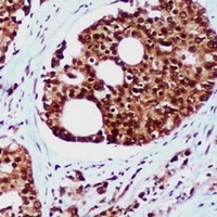 Anti-RAD23B Antibody