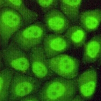 Anti-RAD23B Antibody