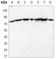 STAT3 Mouse Monoclonal Antibody
