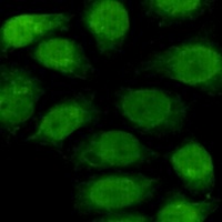 Anti-RPA1 Antibody