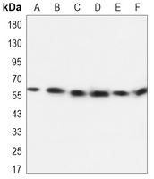 ALDH2 Antibody
