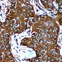 Anti-AMPK beta 1 Antibody