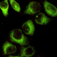 Anti-AMPK beta 1 Antibody