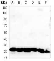 HSP27 Antibody