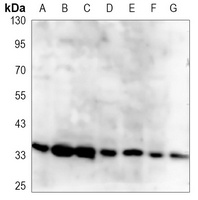 CDX2 Antibody