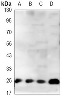 PGP9.5 Mouse Monoclonal Antibody