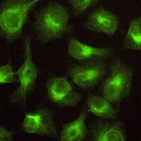Anti-CBR1 Antibody